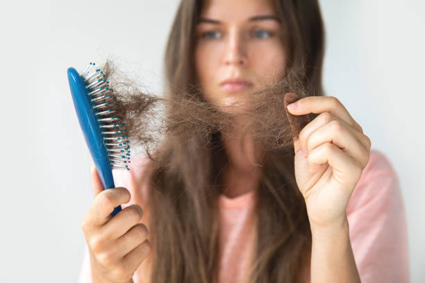 best_hair_treatment_doctor_in_Delhi