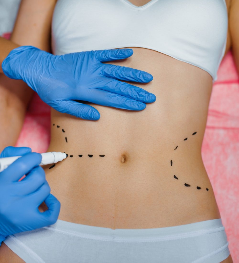 cosmetician-applies-markers-to-female-patient-body